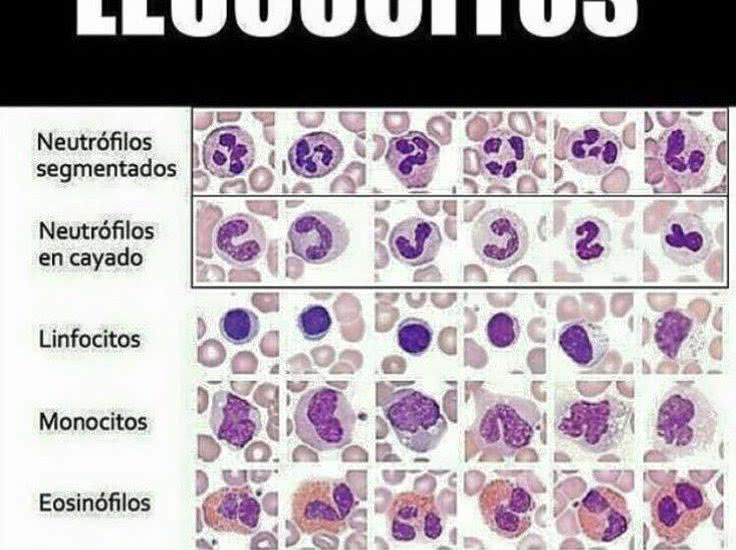 Neutrófilos bajos y linfocitos altos opiniones